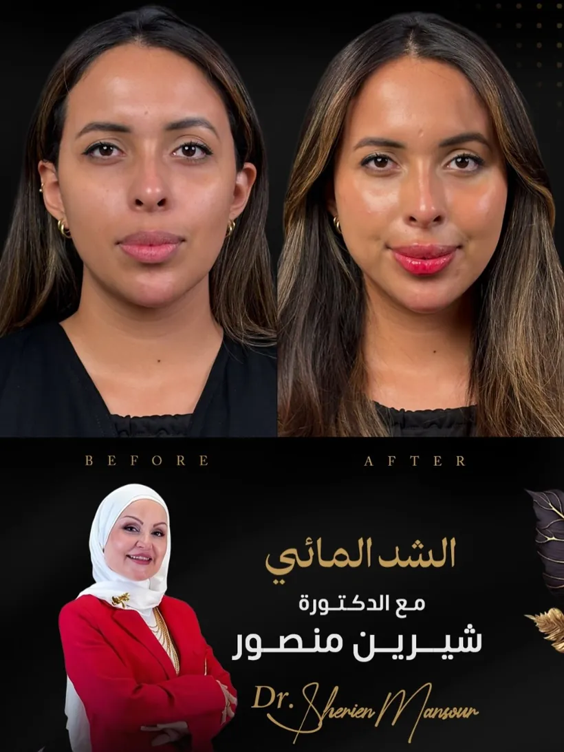 نتيجة